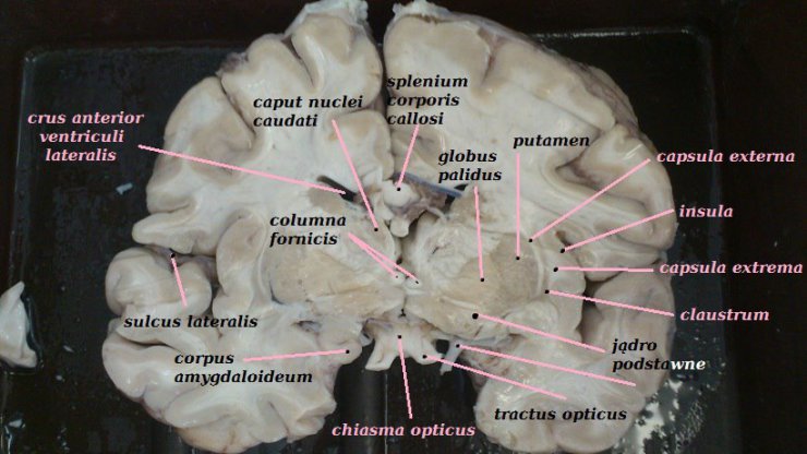 Opisany mózg - 150454_578805778810127_9805291_n.jpg