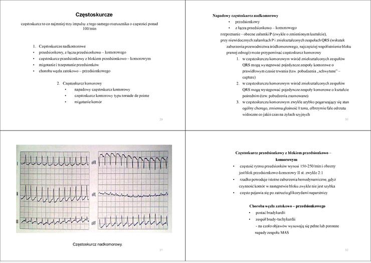 ekg - 1 7.jpg