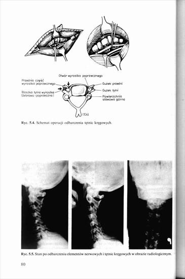 Schorzenia i urazy kręgosłupa, Kiwerski 1997 - 0000077.jpg