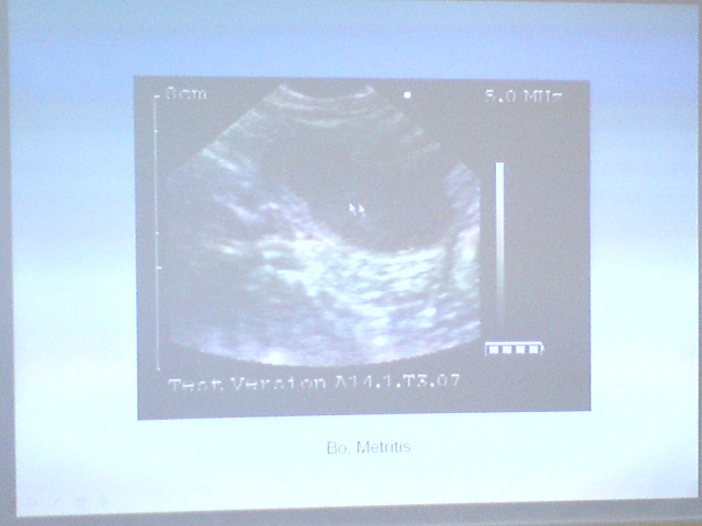 Podstawy ultrasonografii - DSC00573.JPG